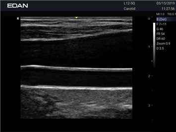 EDAN Acclarix AX2