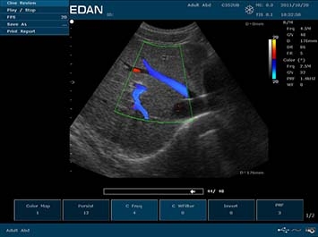 EDAN U50