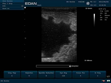 EDAN U50 VET